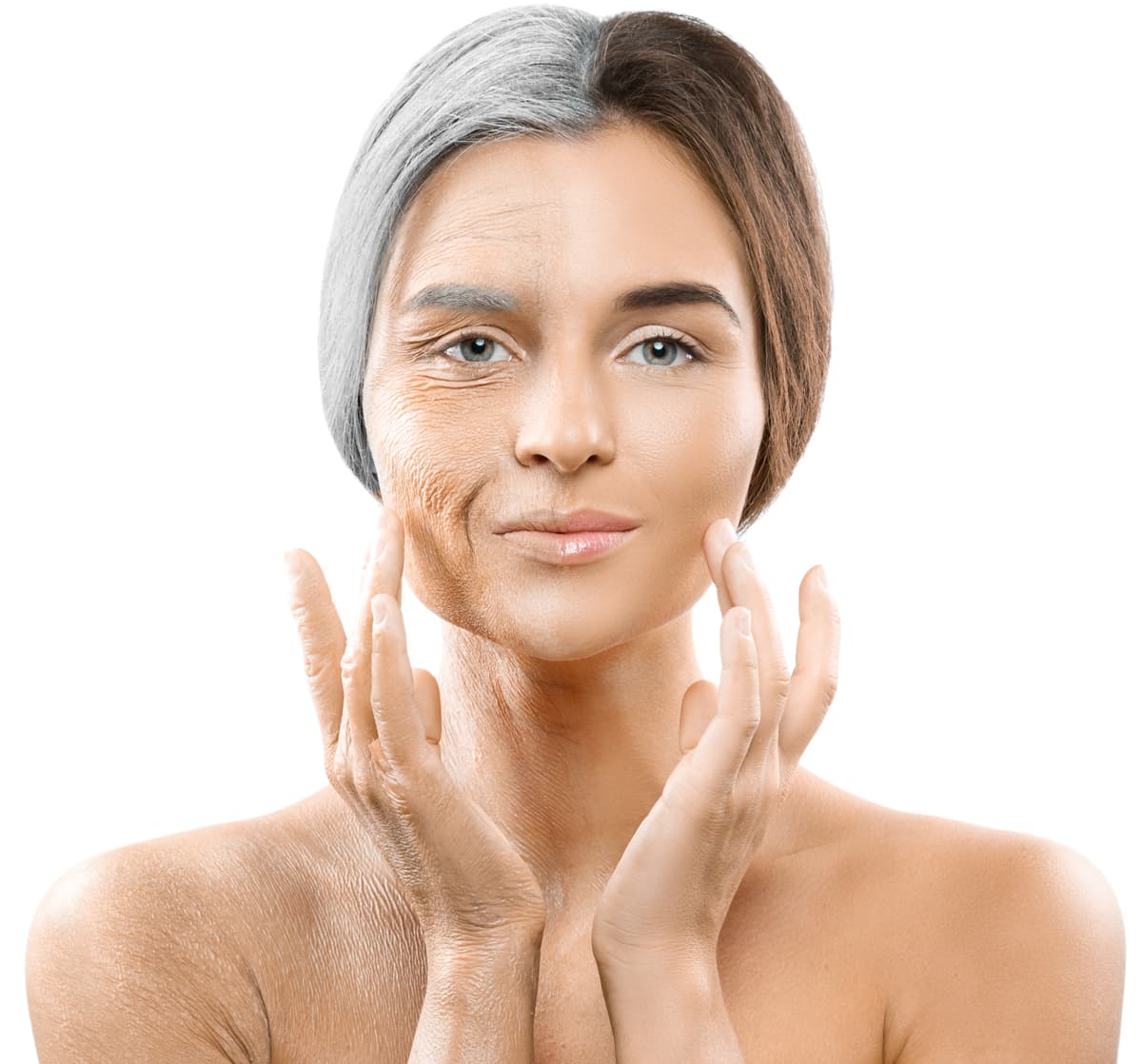 How-to-naturally-achieve-a-botox-effect-on-the-skin.2 opti